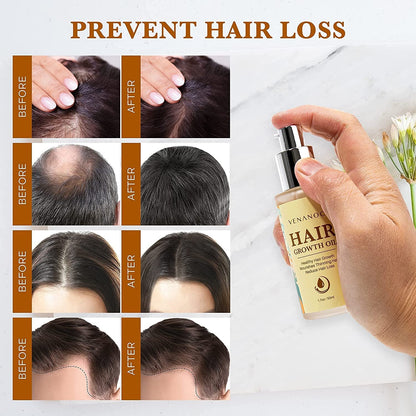 Biotin, Castor & Rosemary Oil for Hair Growth for Women, Hair Loss Treatments for Dry Damaged Hair and Growth, Serum for Thicker Longer Fuller Healthier Hair, All Natural Vitamin Rich Treatment