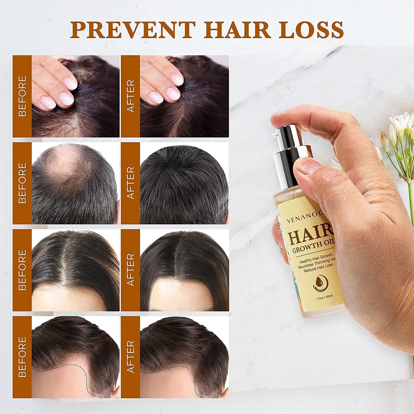 Biotin, Castor & Rosemary Oil for Hair Growth for Women, Hair Loss Treatments for Dry Damaged Hair and Growth, Serum for Thicker Longer Fuller Healthier Hair, All Natural Vitamin Rich Treatment