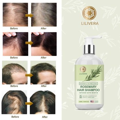 Rosemary Hair Growth Shampoo for Hair Loss, Thinning Hair for Men and Women - Mint Strengthening Shampoo with Tea Tree Oil Bition - 11.8 Fl. Oz