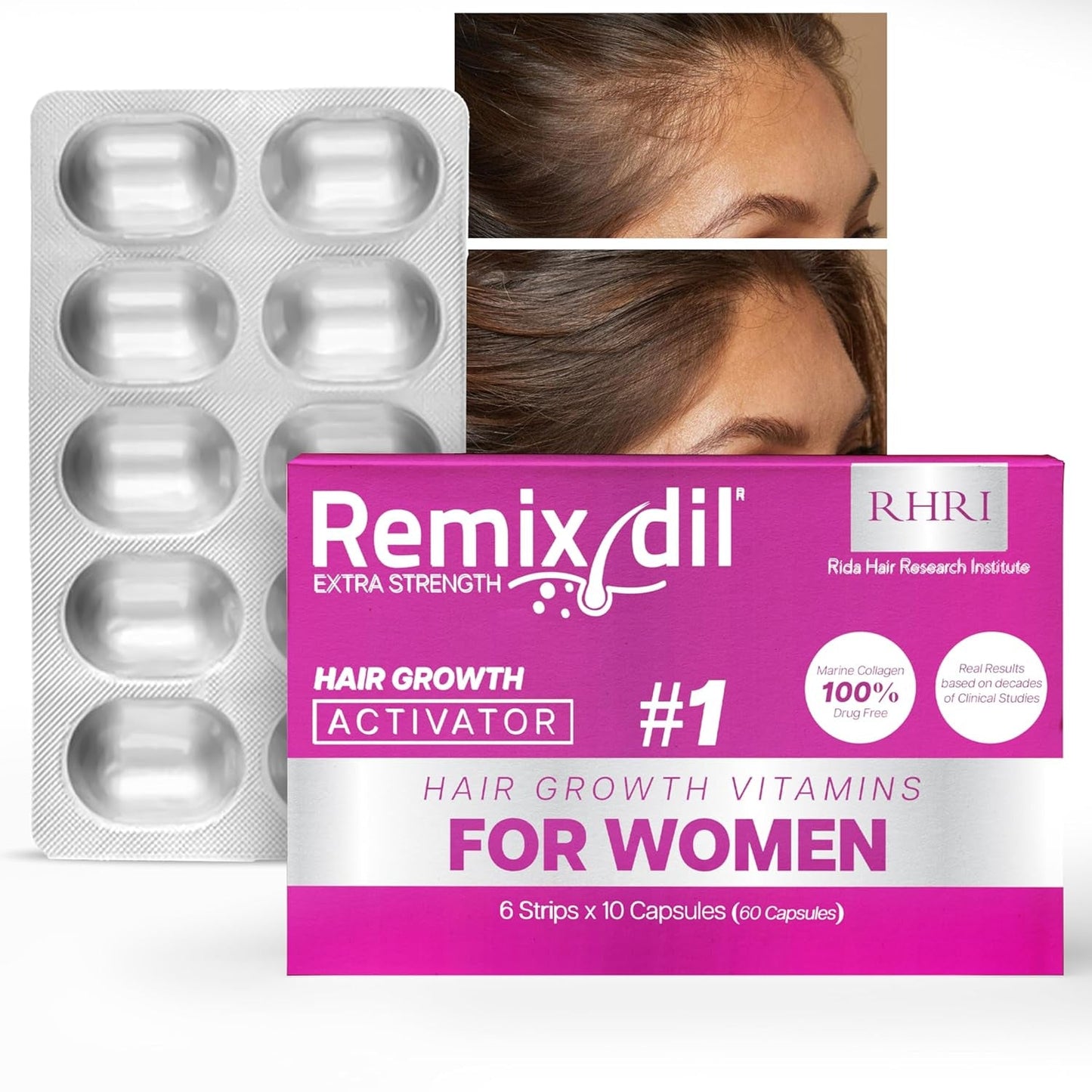 Hair Growth Vitamins for Visibly Thicker & Stronger Hair - Supplements for Hair Loss Treatment and Thinning Hair in Women